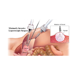 Laparoscopic surgeon in Mumbai