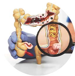 Laparoscopic surgeon in Mumbai